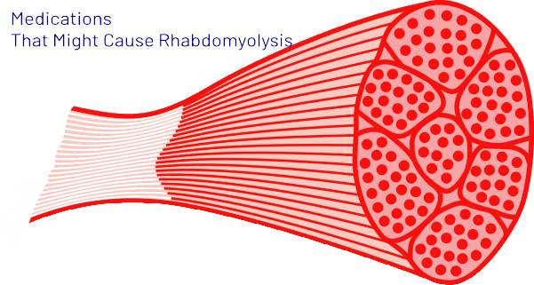 Medications-That-Might-Cause-Rhabdomyolysis